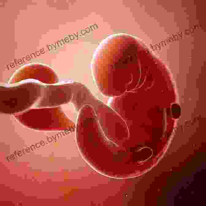 A Microscopic Image Of An Embryo At 6 Weeks Gestation Life Before Birth: The Challenges Of Fetal Development