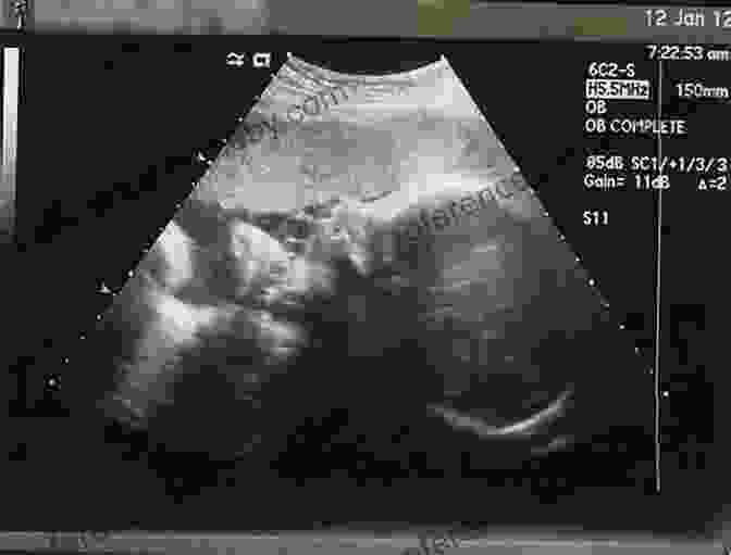 An Ultrasound Image Of A Fetus At 32 Weeks Gestation Life Before Birth: The Challenges Of Fetal Development