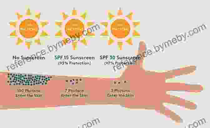 Surfer Applying Sunscreen, Underscoring The Significance Of Sun Protection Surf Survival: The Surfer S Health Handbook