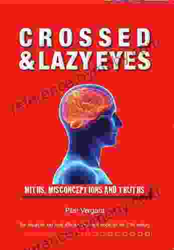 Crossed And Lazy Eyes: Myths Misconceptions And Truths